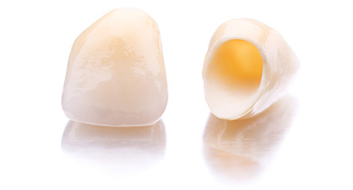 【根管治療のその後は……被せ物の選択】