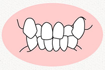 叢生(そうせい)