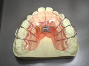床矯正(プレート式)