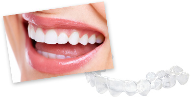 歯並びが気になる大人の方~SmileTRU~