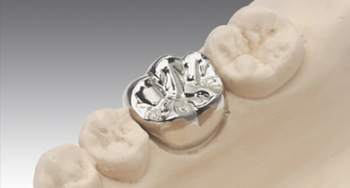 当院のメタルフリー治療への取り組み